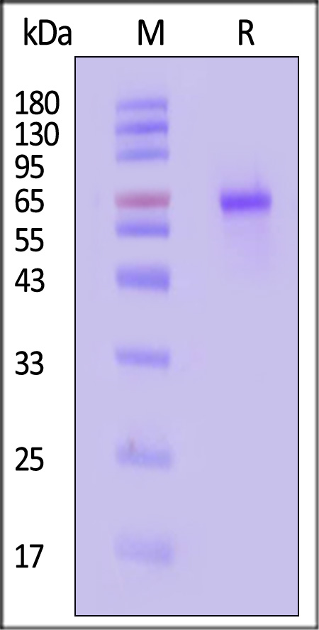 MMP-9 SDS-PAGE