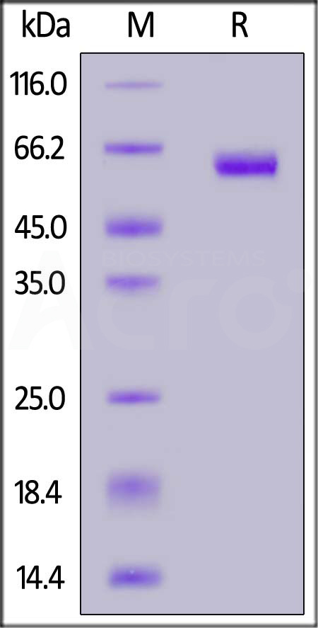 MMP-9 SDS-PAGE