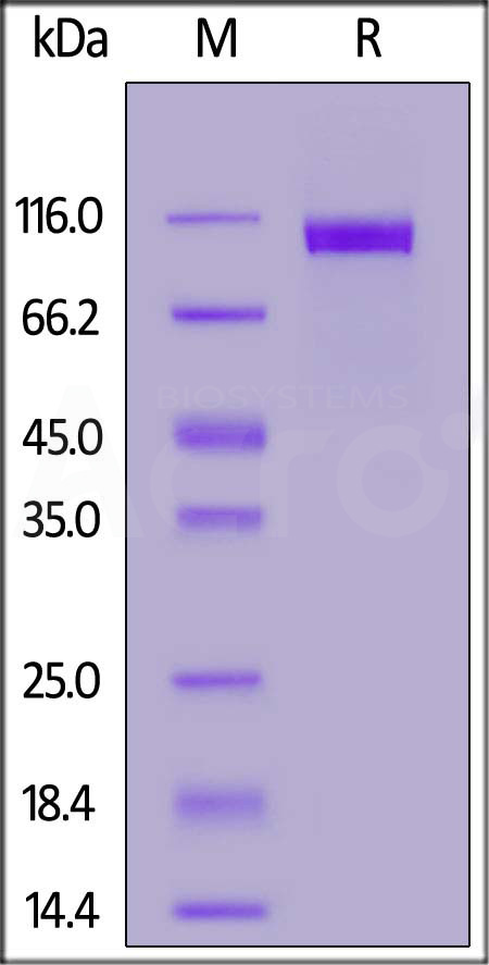 NCAM-1 SDS-PAGE