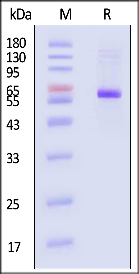 Neuraminidase (NA) SDS-PAGE