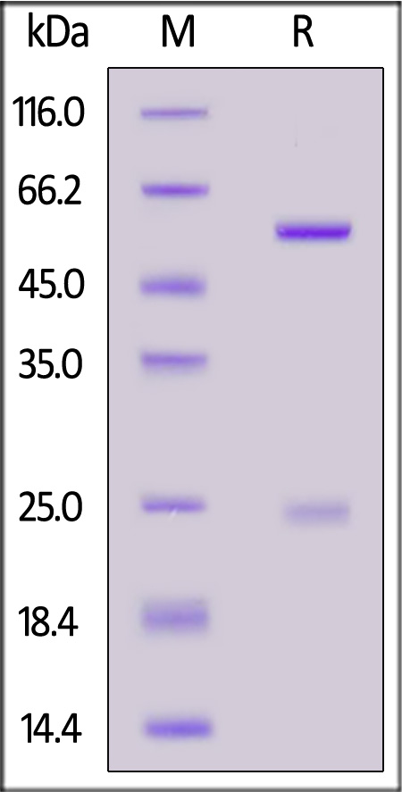 Nucleocapsid protein SDS-PAGE