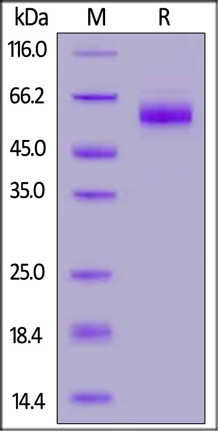 Nucleocapsid protein SDS-PAGE