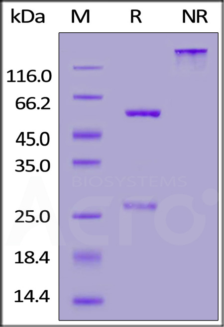 Nucleocapsid protein SDS-PAGE