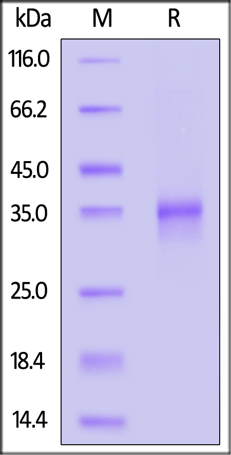 Oncostatin M SDS-PAGE