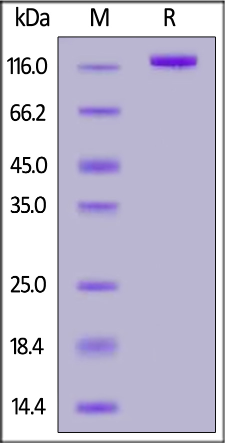 Rat PTK7, Fc Tag (Cat. No. PT7-R5255) SDS-PAGE gel