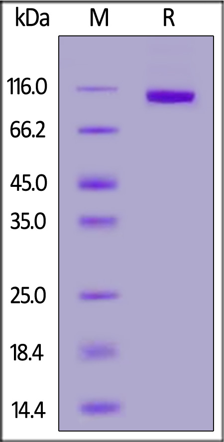 Rat PTK7, His Tag (Cat. No. PT7-R52H6) SDS-PAGE gel