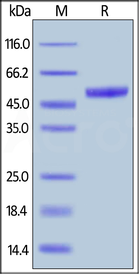 Mouse PVRIG, Fc Tag (Cat. No. PVG-M5257) SDS-PAGE gel