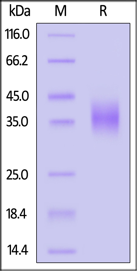 Human uPAR (112-303), His Tag (Cat. No. UPR-H52H4) SDS-PAGE gel