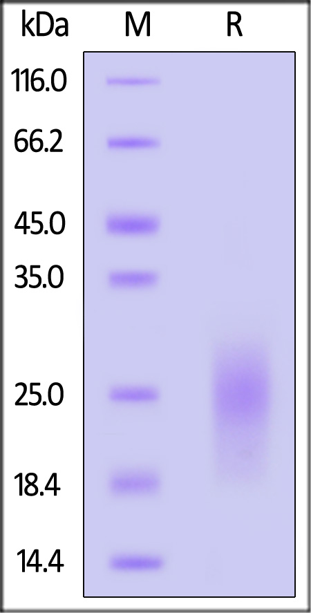 Human uPAR (209-303), His Tag (Cat. No. UPR-H52H6) SDS-PAGE gel