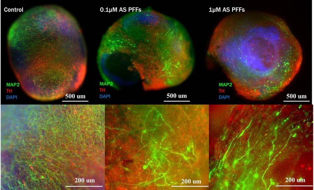  - ORGANOID APPLICATION